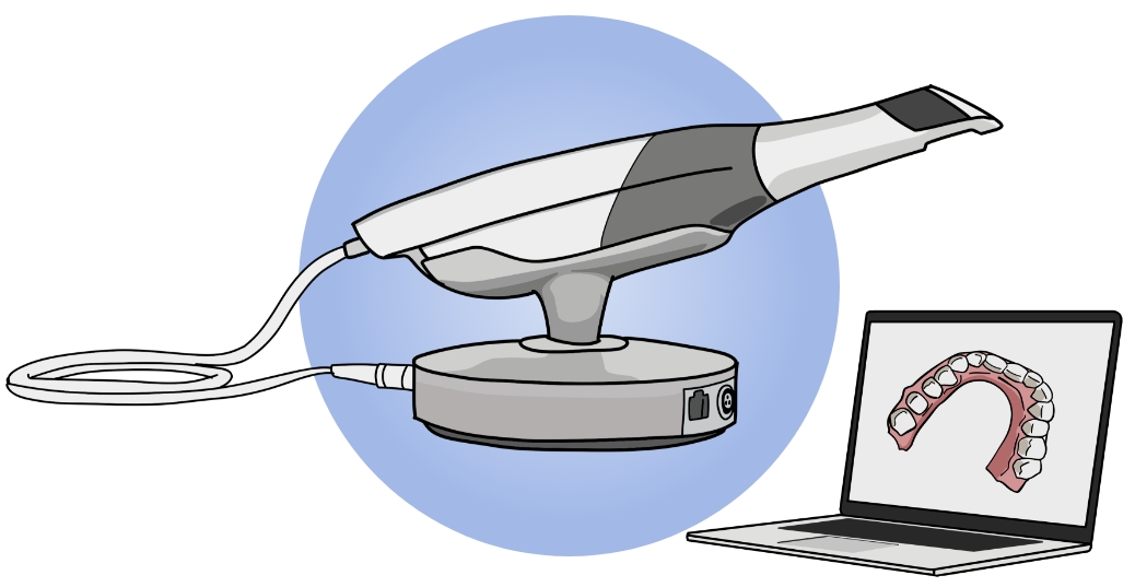 口腔内スキャナー